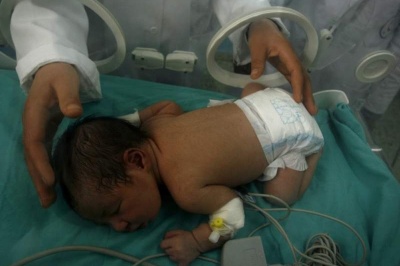 پیشگیری از اچ‌آی‌وی در کودکان با یکبار تزریق ژن‌درمانی