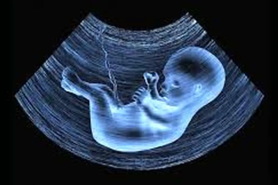 ترکیه مقصد جدید غربالگری جنین / افزایش آمار بیماران هموفیلی پس از قانون جوانی جمعیت