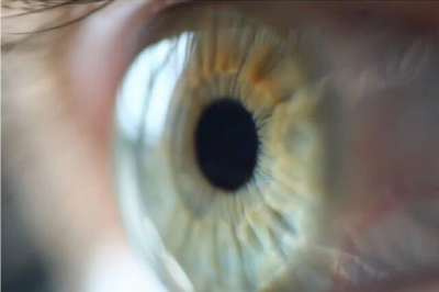 سرماخوردگی چشمی؛ بیماری شایعی که به سرعت اعضای خانواده را درگیر می‌کند