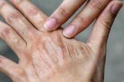 اشتباه‌های رایج در مراقبت روزانه از پوست