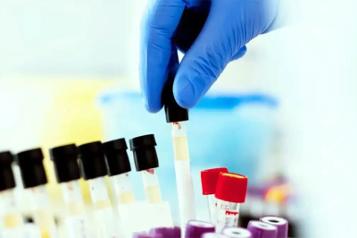 پاپ اسمیر، سپر دفاعی زنان در برابر سرطان و ناباروری / ترس و شرم، مانعی برای حفظ سلامت