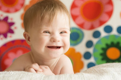 رییس مرکز جوانی جمعیت وزارت بهداشت:‌ برای جنین‌های دارای سندروم داون، سقط مجاز نیست