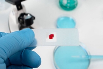 شیردهی از عوامل کاهش احتمال ابتلا به سرطان سینه