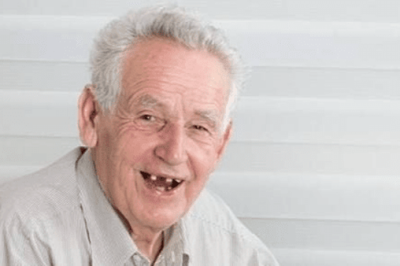 نیمی از افراد بالای ۶۵ سال هیچ دندانی ندارند