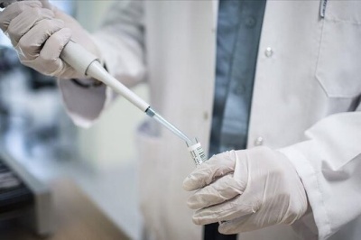 ابراز نگرانی WHO نسبت به افزایش شدید موارد ابتلا به «اچ‌آی‌وی» در چند کشور