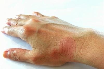 کشف جدید دانشمندان درباره علت بیماری 