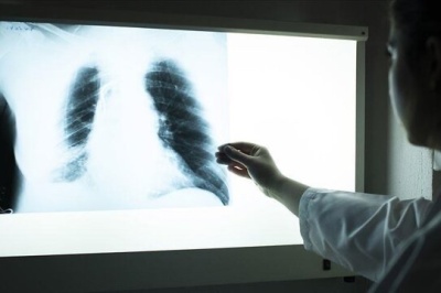 آلودگی هوا و دخانیات؛ دو تهدید اصلی برای بیماری‌های مزمن ریوی