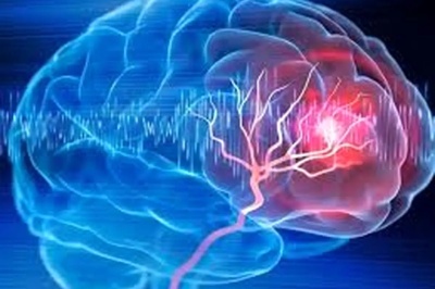 تغییر نرخ ارز درمان نوپای سکته مغزی دچار مشکل کرده است